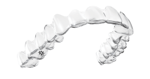 , Invisalign Streatham